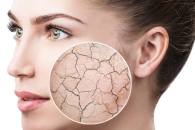 بهترین کرم مرطوب کننده برای پوست خشک